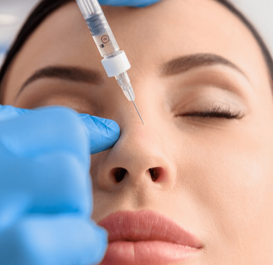 How To Use Fillers On The Nose | Nose Bridge Filler London ...