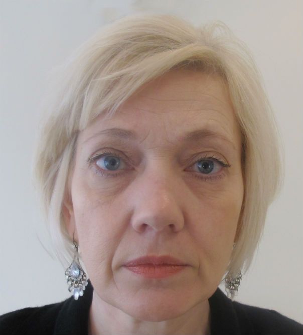 Before image of non-surgical facelift using Juvéderm dermal fillers