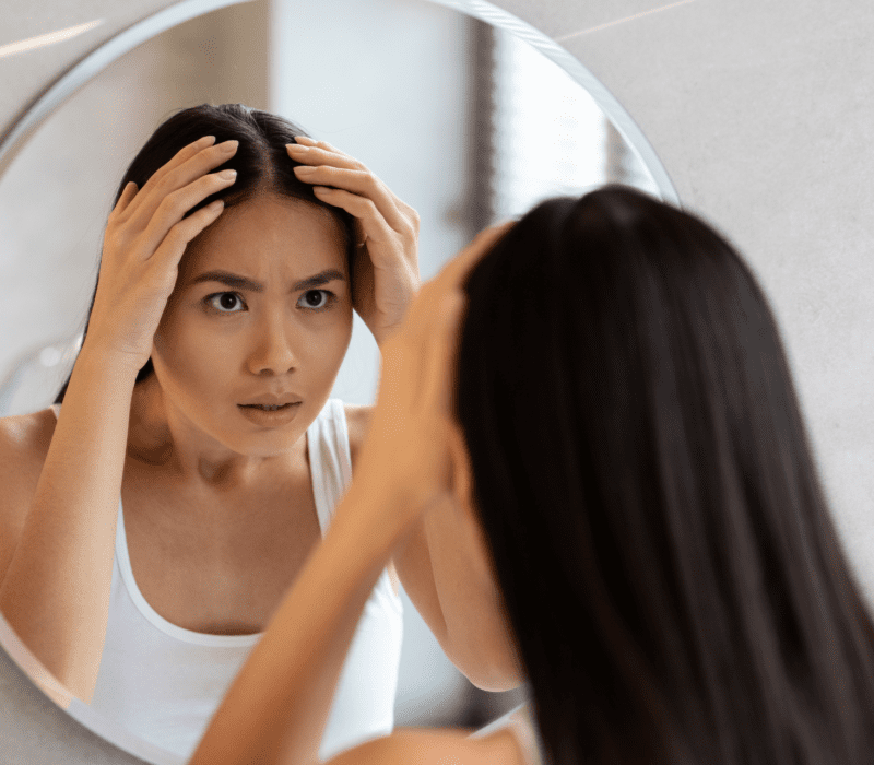 Calecim Advanced Hair Loss Treatment
