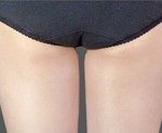 Best treatment for top inner thigh fat