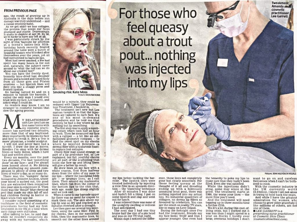 Daily Mail - Amanda Platell barcode lip lines article