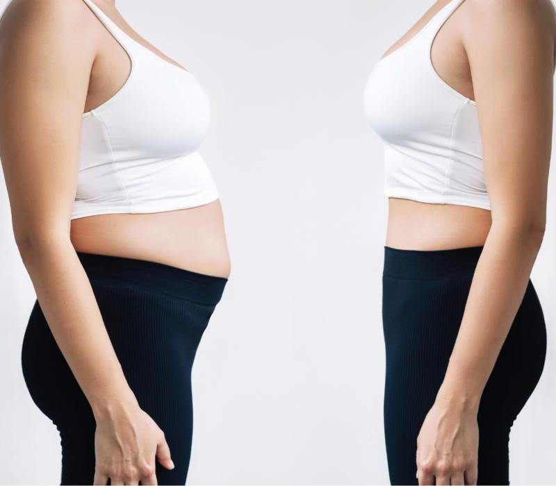 Fat Reduction Experts