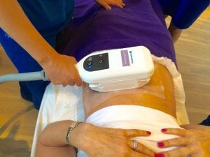 Coolsculpting