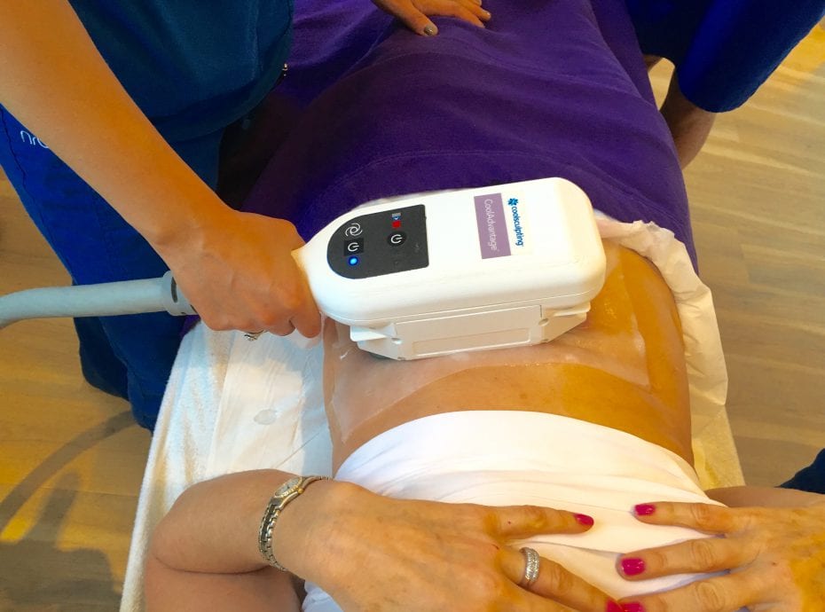 Coolsculpting Before and After