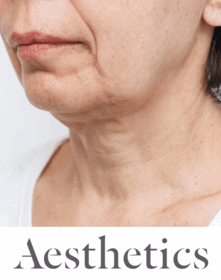 GLP-1s and Facial Changes: How Dr Victoria Manning Supports Patients After Weight Loss
