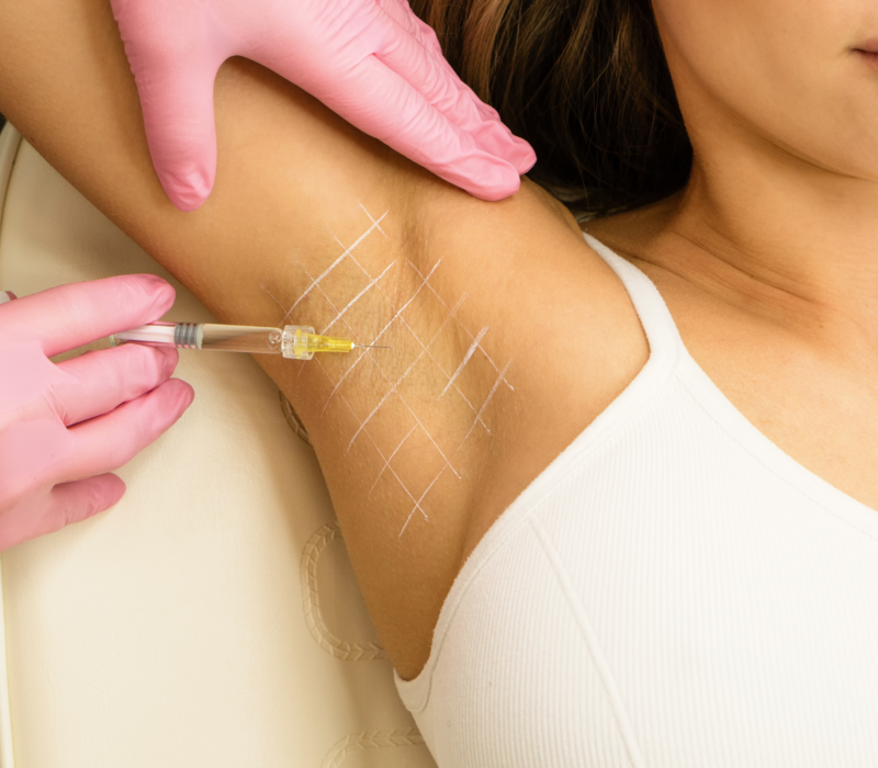 Hyperhidrosis treatment