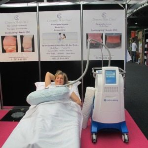 A very comfortable Ali on a Coolsculpting treatment - results to follow...