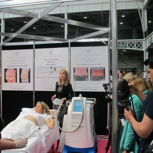 Dr Mountford demonstrating Coolsculpting non-surgical fat loss treatment
