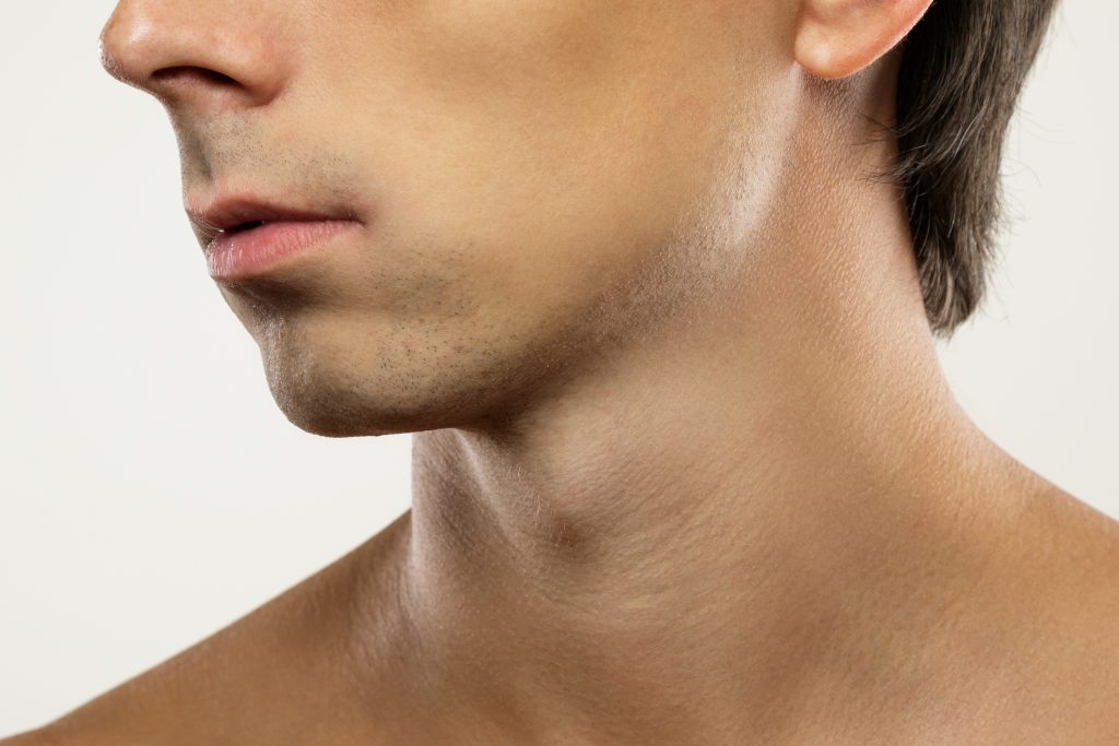 jowls tweakments for men