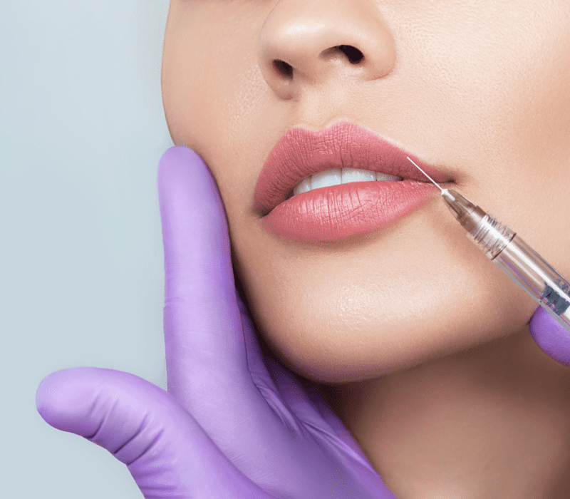 Best Dermal Fillers London, near Harley Street | Facial Fillers near me in  London, Bucks