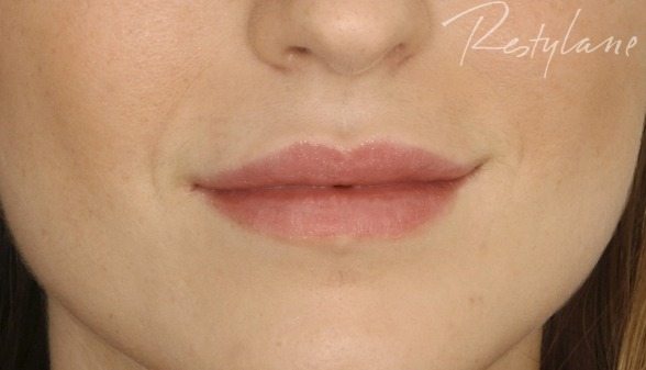 Lips after Lips.3.After