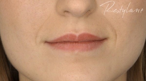 Lips before Lips.3.Before