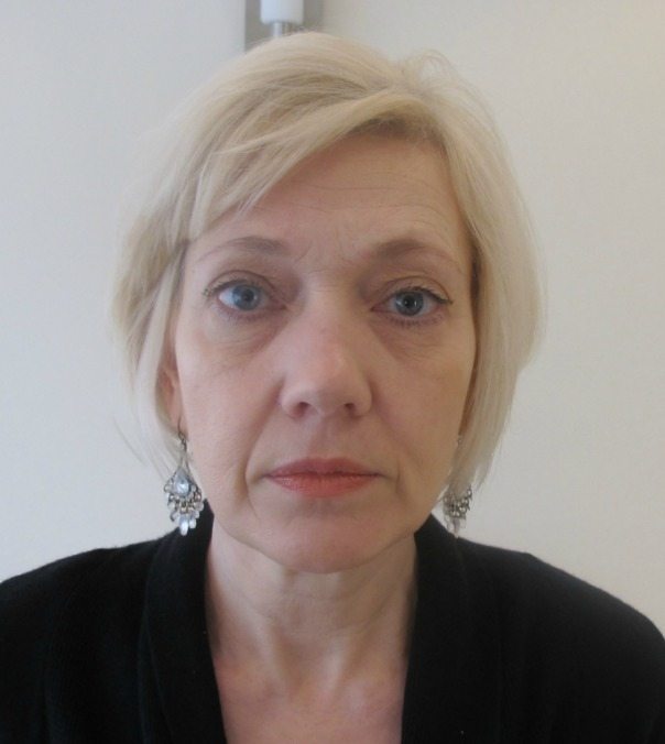 A lady before undergoing a full face rejuvenation with Juvederm Vycross and chin fillers.