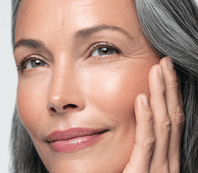 NeoGen plasma treatment in Buckinghamshire