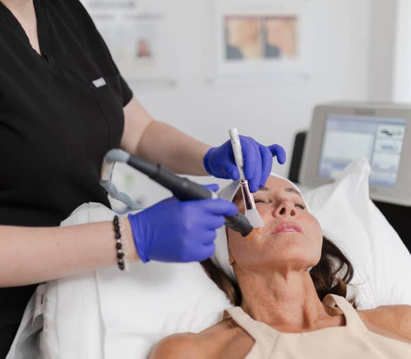 Non-Surgical Facelift