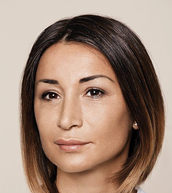 A lady's face following Restylane to the lips, nasolabial folds and marionette lines