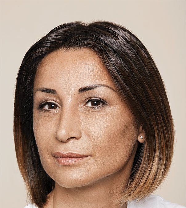 The face of a lady prior to having treatment to the lips, nasolabial folds and marionette lines