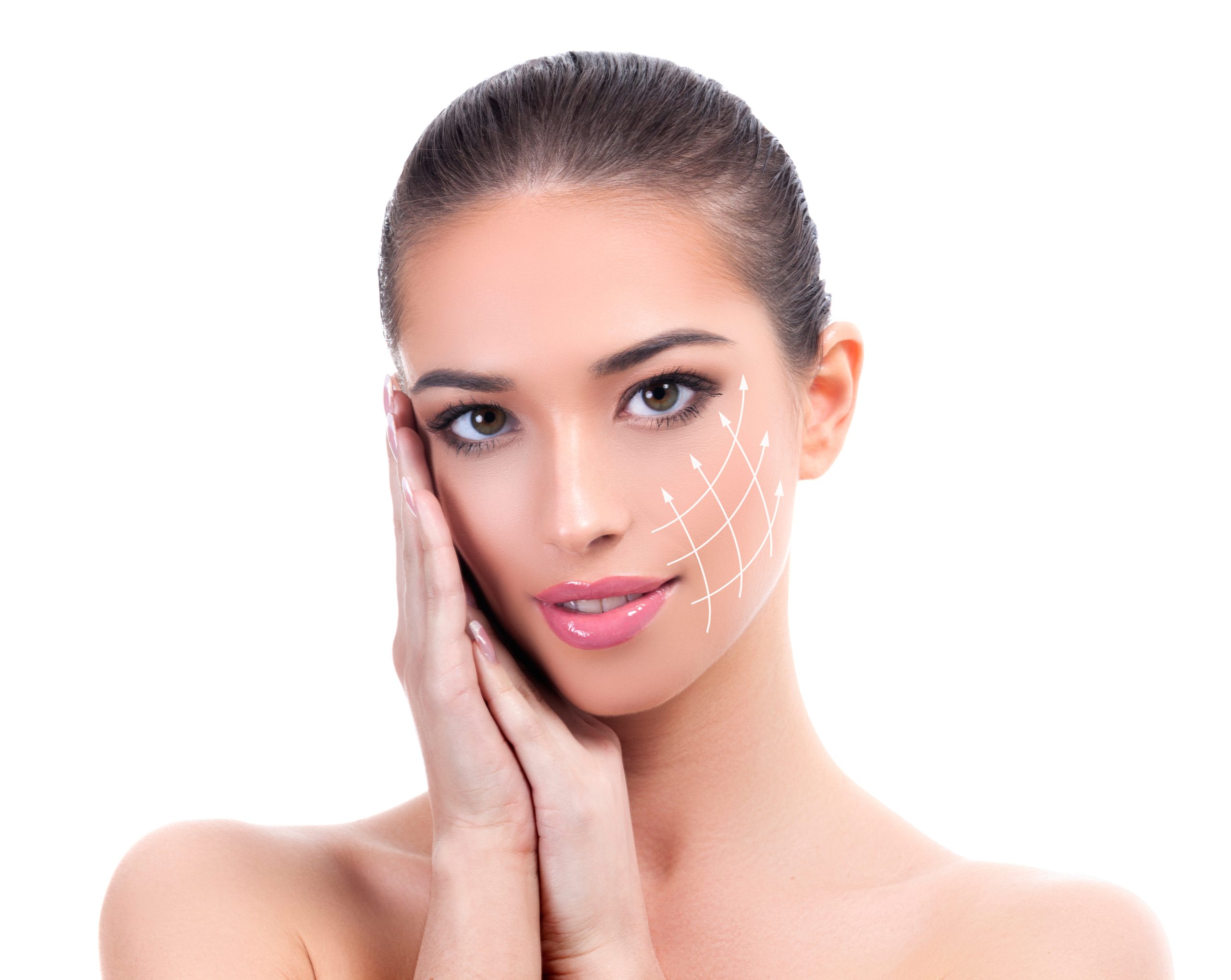 Silhouette Soft Thread Lifting The Cosmetic Skin Clinic
