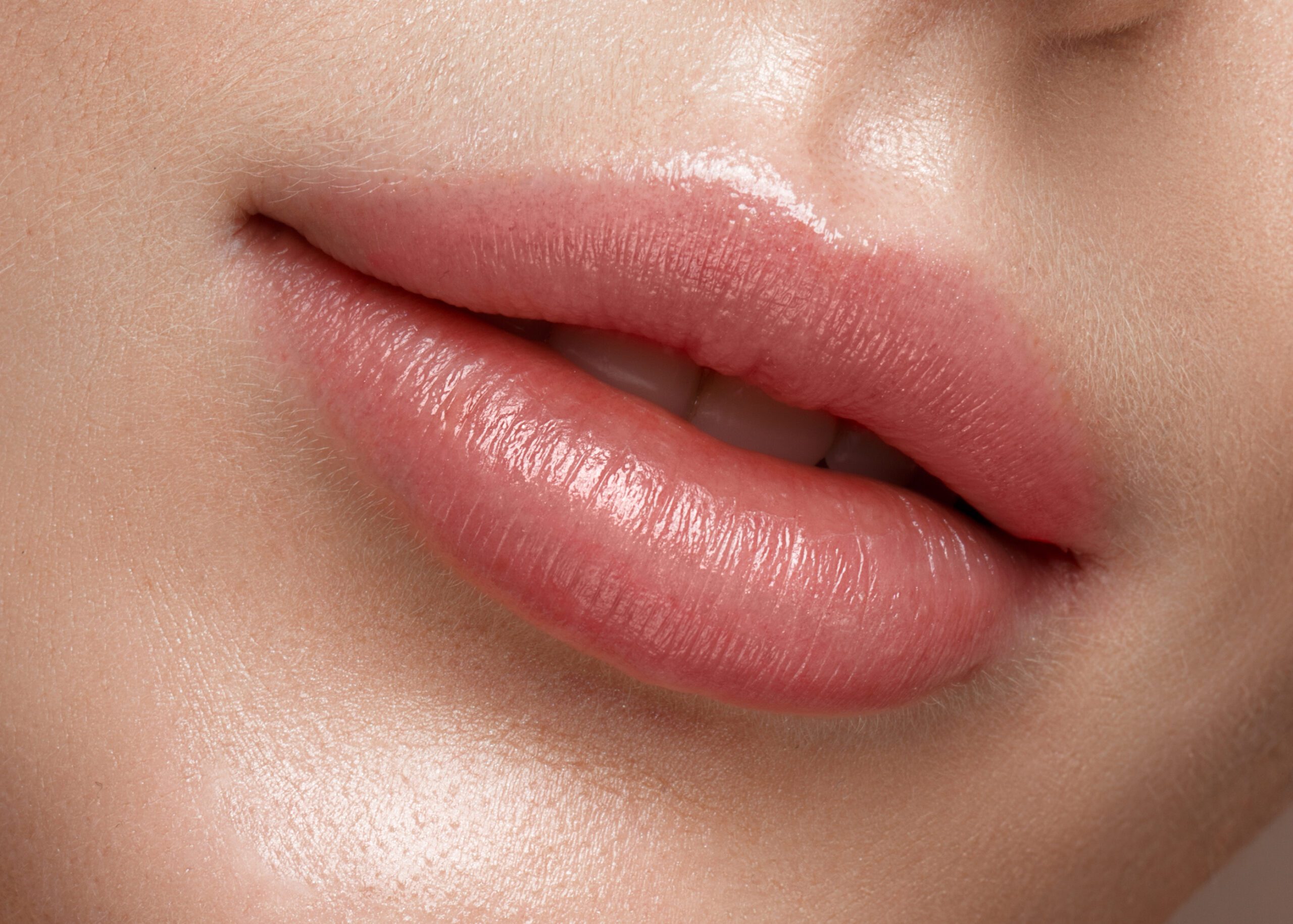 The Best Way to Fix Downturned Mouth Corners Filler, Botox for