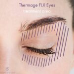 Thermage FLX Non surgical Eyes lift infographic