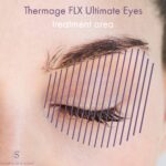 Thermage FLX Ultimate Non surgical Eye Lift infographic