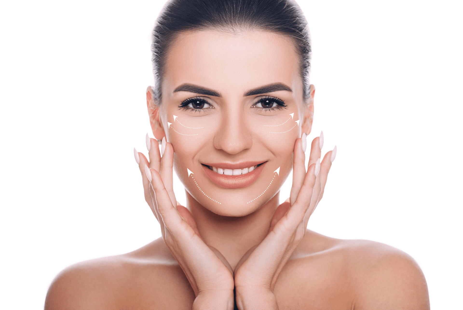 Silhouette Soft Thread Lift for Skin Rejuvenation in London, Bucks &  Bournemouth