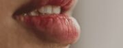 Types of lip filler injections and what our top injectors recommend