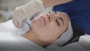 ultherapy, ultherapy treatment, ultherapy procedure