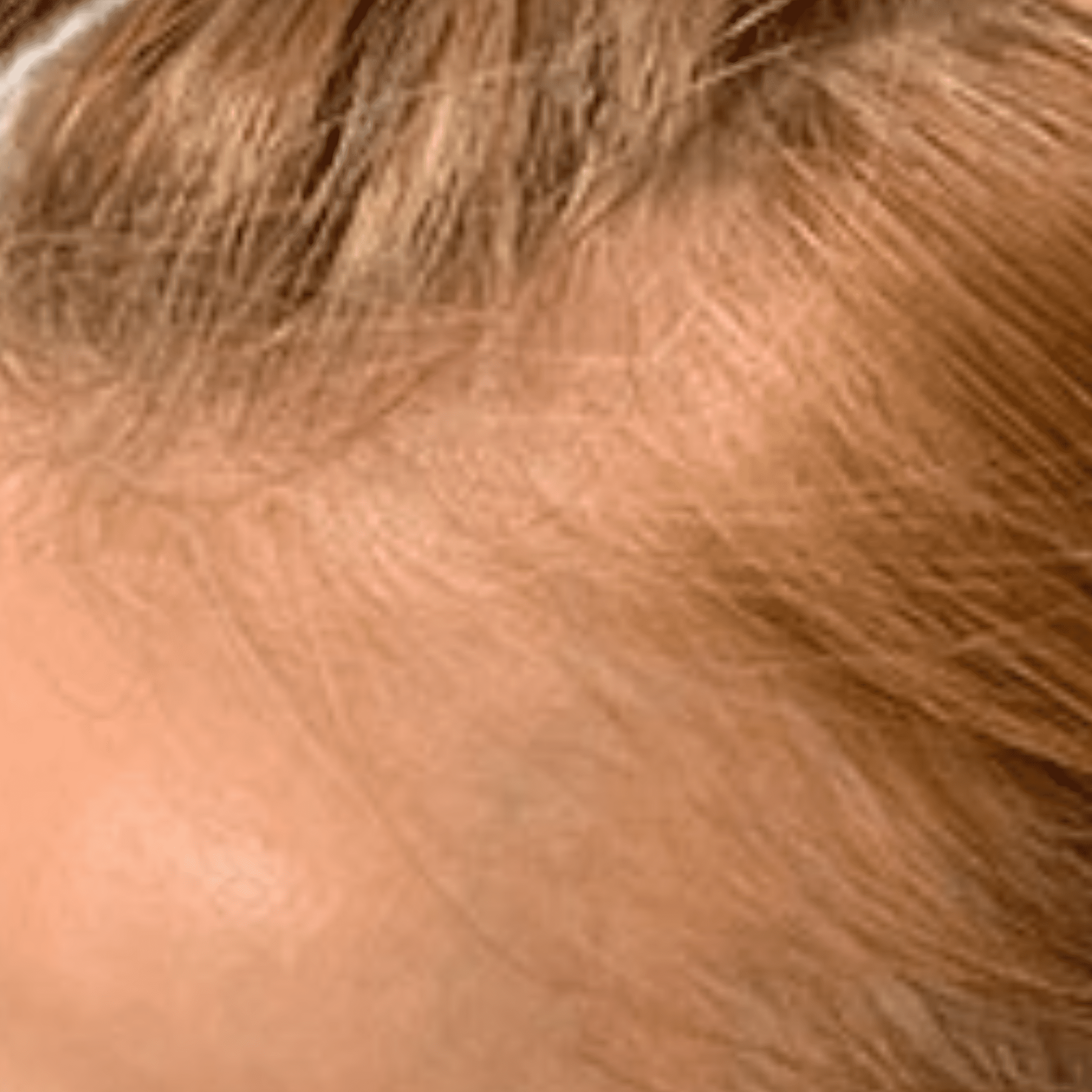 Non-Surgical Hair Loss Treatment