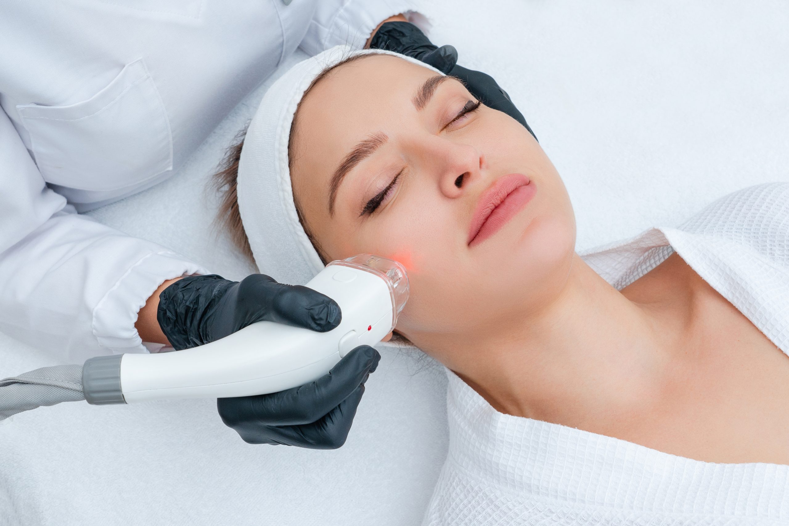 best laser treatments