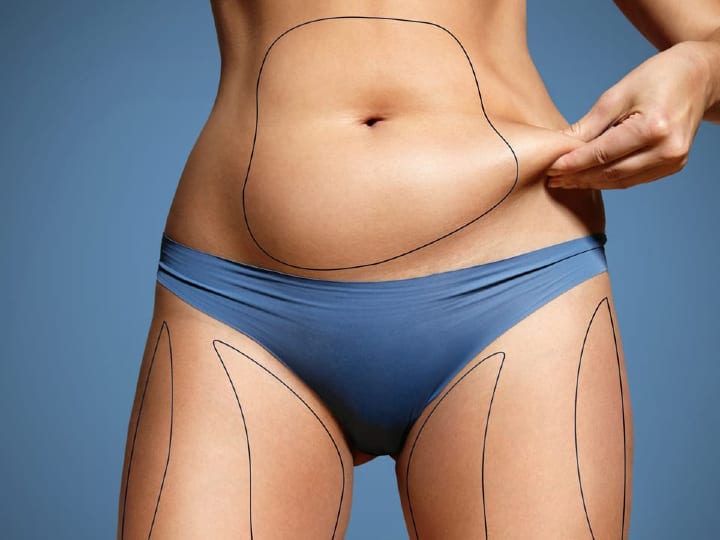 Body Contouring CoolSculpting Sculpsure