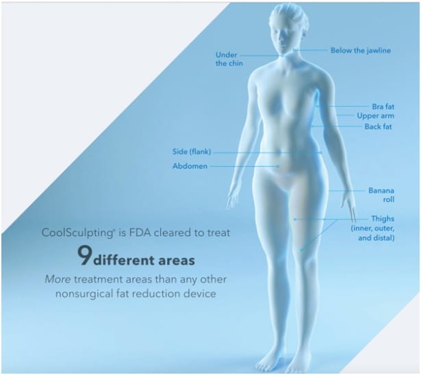 Coolsculpting elite treatment areas