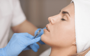 dermal fillers treatment