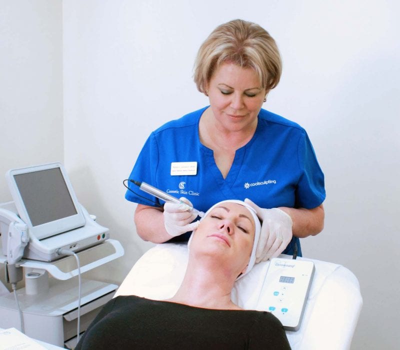 A lady undergoing treatment with a dermaroller