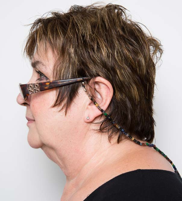 Jenni Murray before double chin treatment