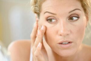 eye rejuvenation veins under eyes