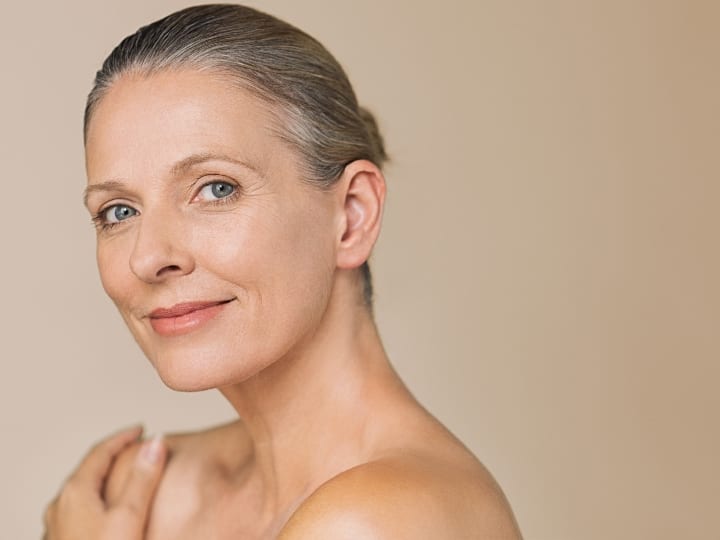 Mid-face lift Dermal Fillers for a 50s Patient