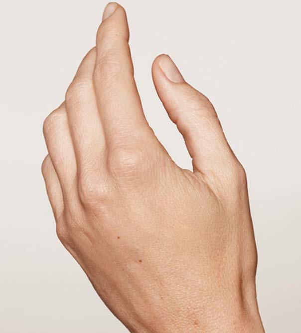 A lady's hand after hand rejuvenation treatment