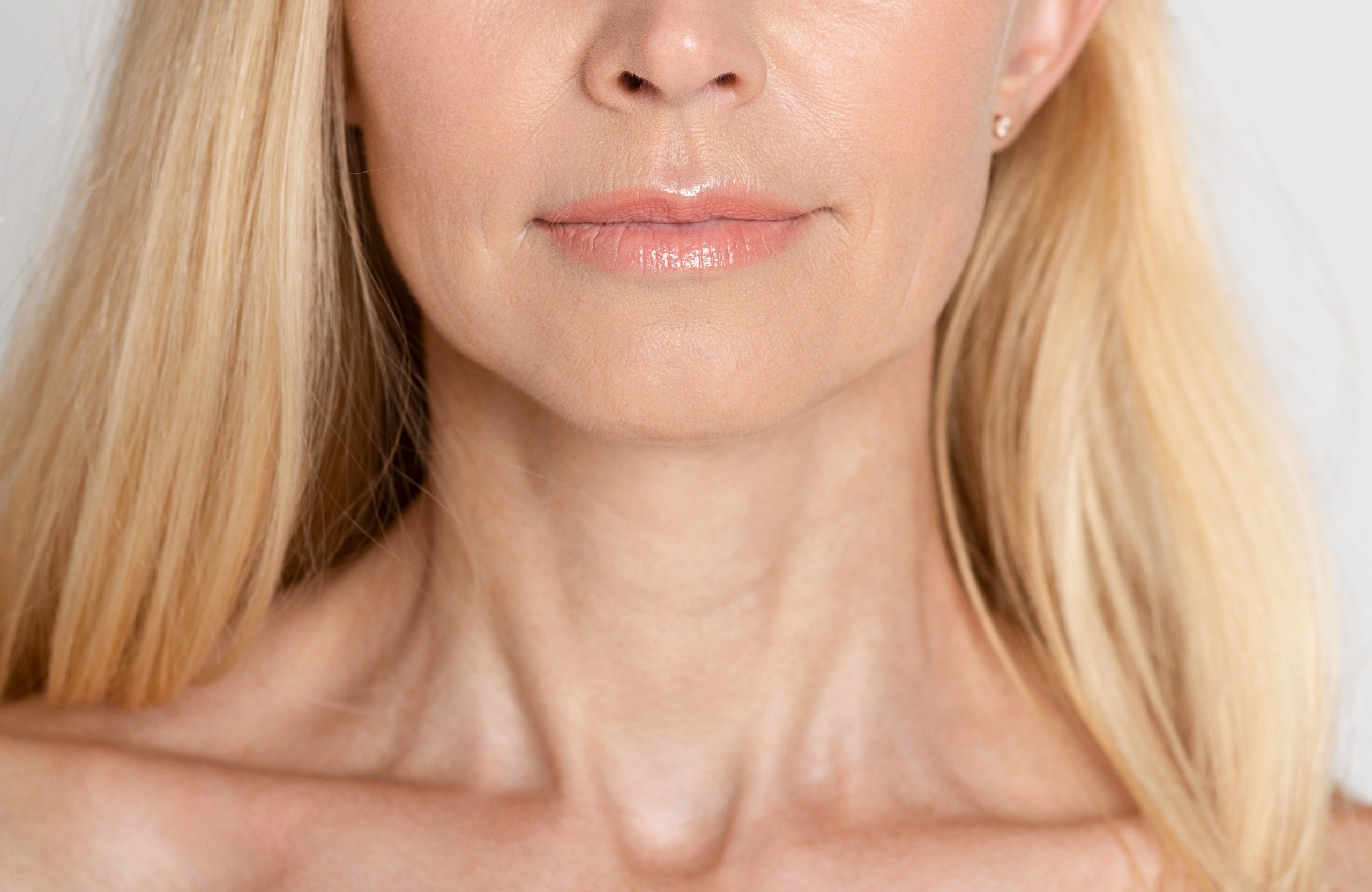 How To Get Rid Of Jowls With Filler