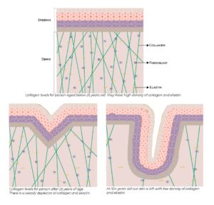 how we loose collagen infographic - collagen boosting treatments