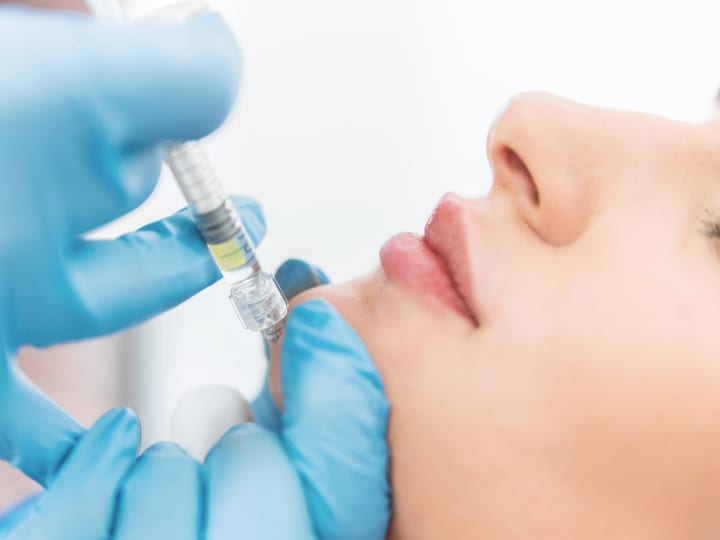 Skin Tightening Injectables