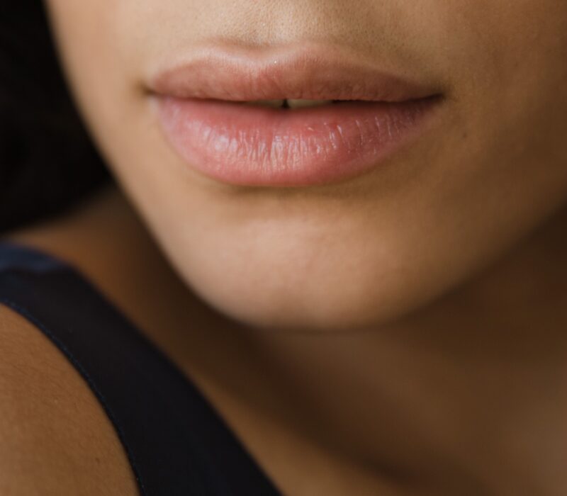 lip fillers
