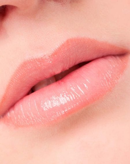 What can be done about Lip Wrinkles?