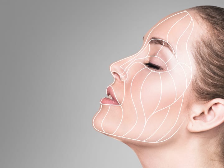 Mid Face Lift Using Fillers Mid Face Lift Using Fillers