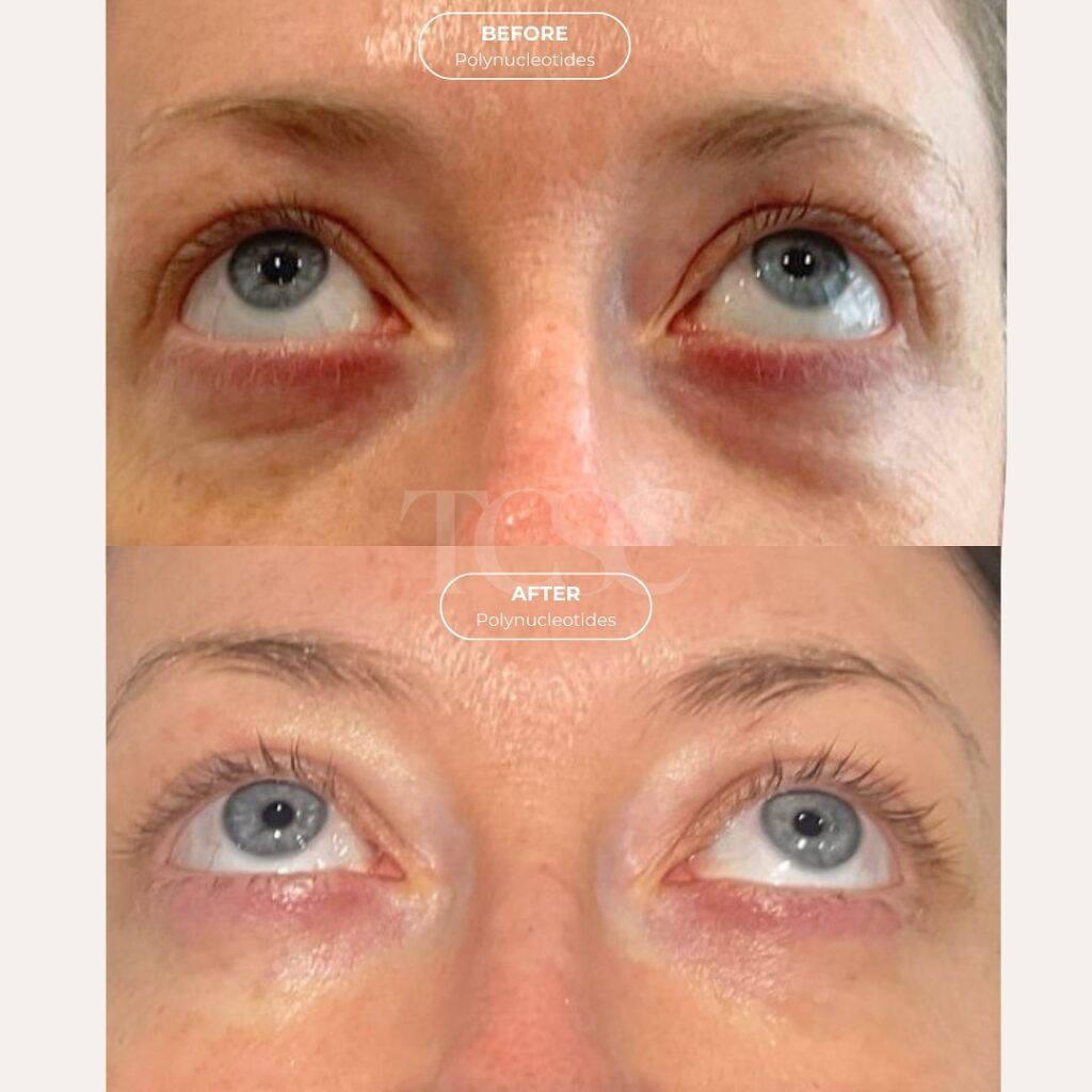 polynucleotides before and after