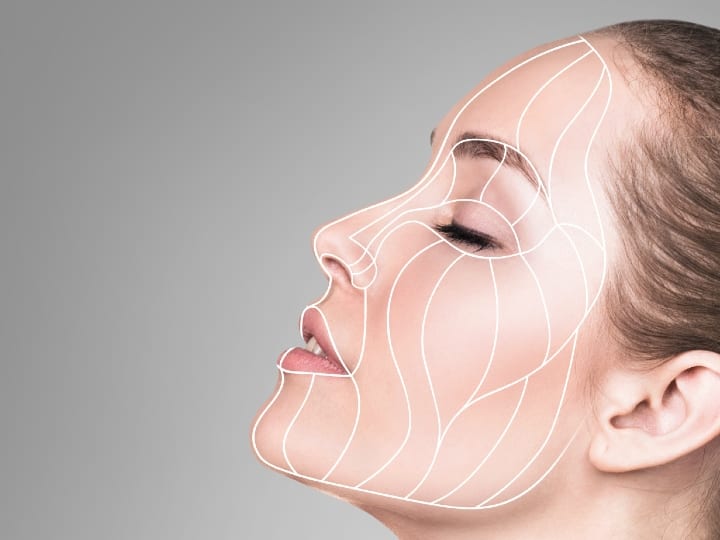 Profhilo for face Profhilo Bio Remodeller