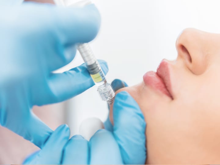 Chin fillers Treatment Replacing Lost Volume with Chin Fillers