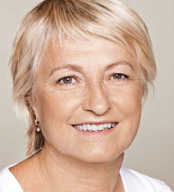 A lady following Restylane treatments to the face