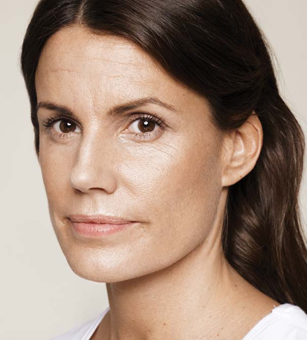 A lady before using Skinboosters