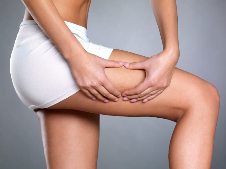 How To Slim Your Thighs Without Surgery - The Cosmetic Skin Clinic